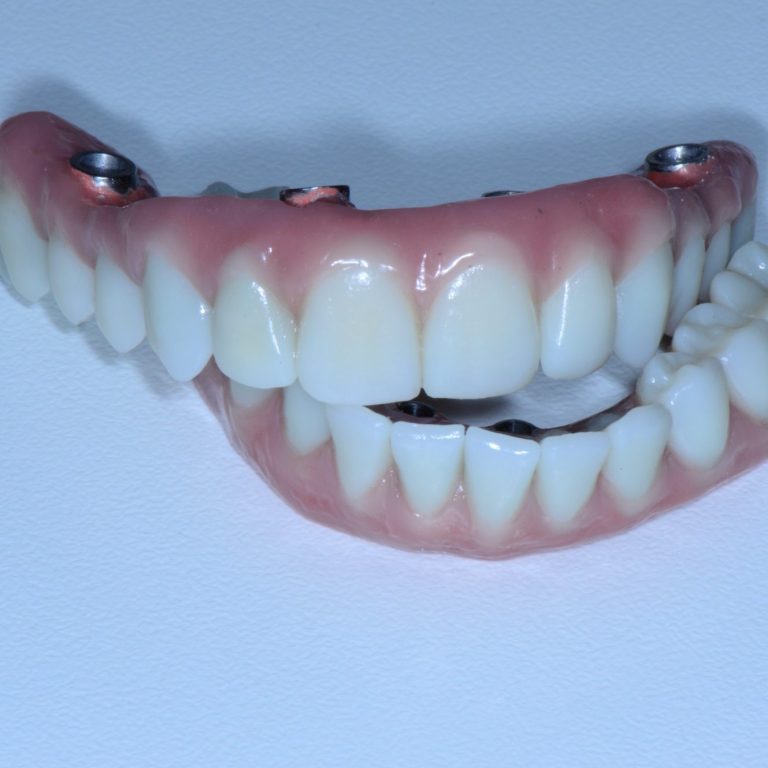 zirconio