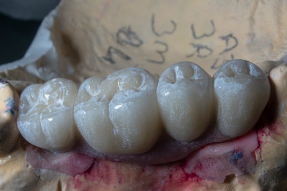 Corone ceramica
